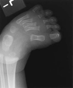 Figura 2: Aspect radiografic / Poziționare (Clark Ed. 12)