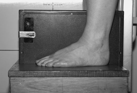 Dorso-Plantară Ortostatism incidență de Ambele Picioare evidențiind hallux valgus