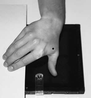 Normal Profil (lateral) radiografie de Police