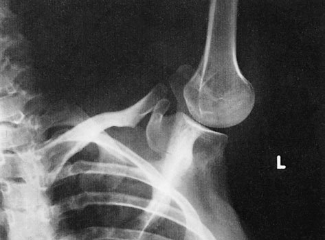 Figura 3: Aspect radiografic / Poziționare (Clark Ed. 12)