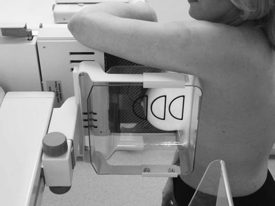 • Compression este applied while radiographer’s Mână