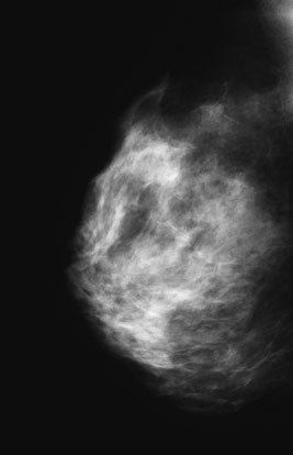 detail, e.g. micro-calcificări patologice, great care trebuie să fie taken la