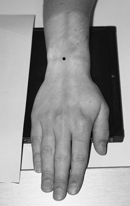 Normal Postero-anterior (PA)