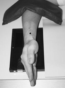 radiografie de Pumn (Articulație Radiocarpiană)
