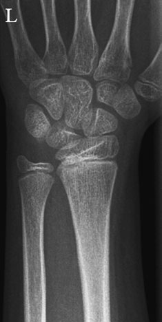 Figura 4: Aspect radiografic / Poziționare (Clark Ed. 12)
