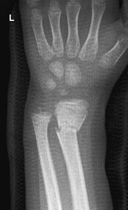 Figura 4: Aspect radiografic / Poziționare (Clark Ed. 12)
