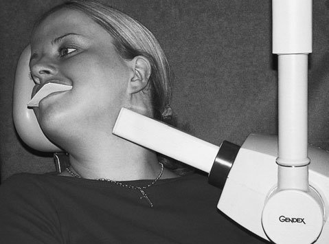 Figura 2: Aspect radiografic / Poziționare (Clark Ed. 12)