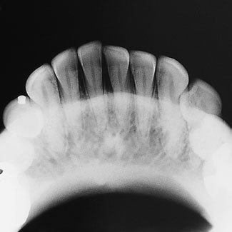 10 Radiografie dentară ocluzală