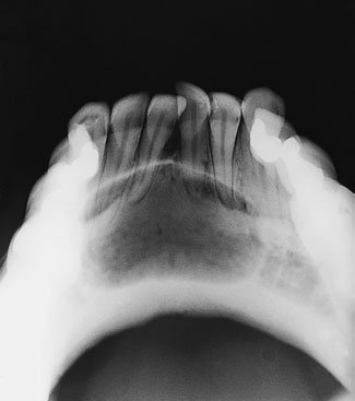 Figura 3: Aspect radiografic / Poziționare (Clark Ed. 12)