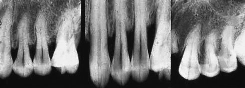 Figura 7: Aspect radiografic / Poziționare (Clark Ed. 12)