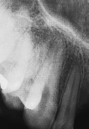 Figura 9: Aspect radiografic / Poziționare (Clark Ed. 12)