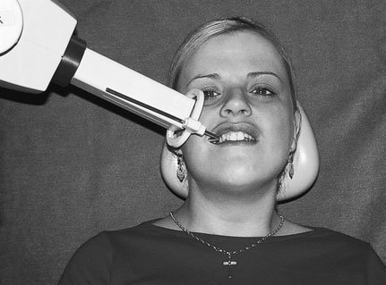 10 Radiografie Dentară Retroalveolară (Periapicală)