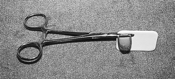 10 Radiografie Dentară Retroalveolară (Periapicală)