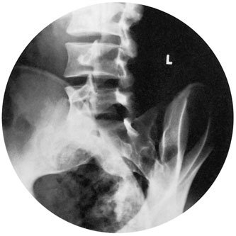 Figura 2: Aspect radiografic / Poziționare (Clark Ed. 12)