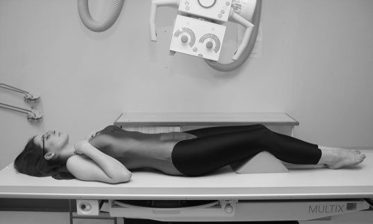 Normal Antero-posterior (AP) incidență de Articulații Sacroiliace