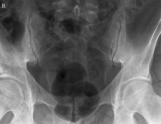 Figura 2: Aspect radiografic / Poziționare (Clark Ed. 12)