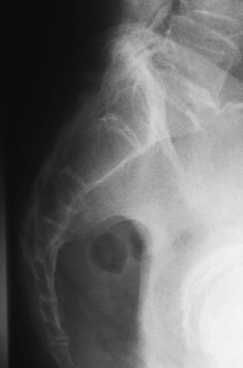 Figura 5: Aspect radiografic / Poziționare (Clark Ed. 12)