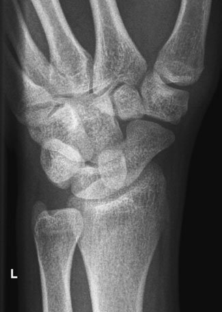 Figura 3: Aspect radiografic / Poziționare (Clark Ed. 12)