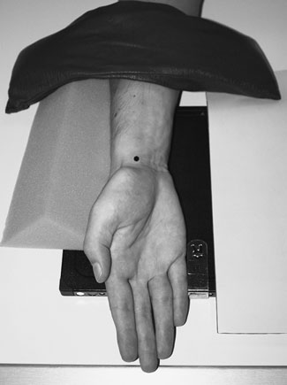Oblică Posterioară radiografie de Pumn (Articulație Radiocarpiană)