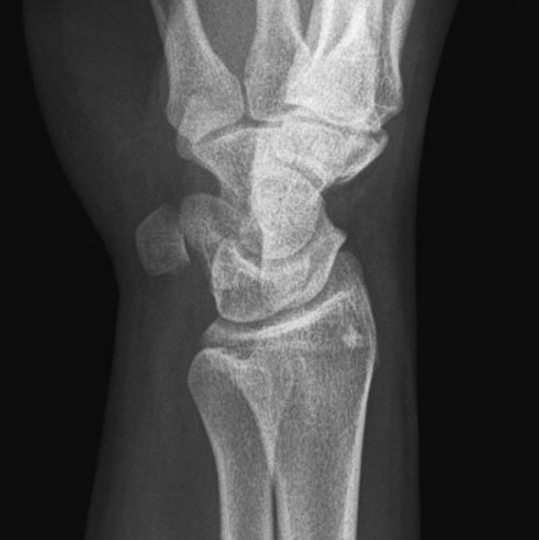 Figura 3: Aspect radiografic / Poziționare (Clark Ed. 12)