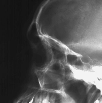 Figura 4: Aspect radiografic / Poziționare (Clark Ed. 12)
