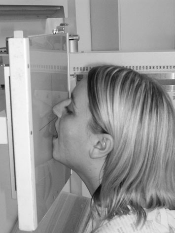Radiografie OM pentru sinusurile paranazale (SAF), evidențiind un polip în sinusul maxilar drept