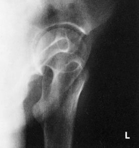 Figura 2: Aspect radiografic / Poziționare (Clark Ed. 12)