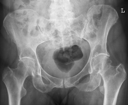 unnecessary repeat radiografie.