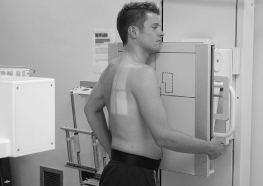 Radiografie oblică postero-anterioară (PA) a sternului efectuată