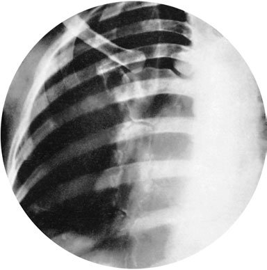 Figura 2: Aspect radiografic / Poziționare (Clark Ed. 12)