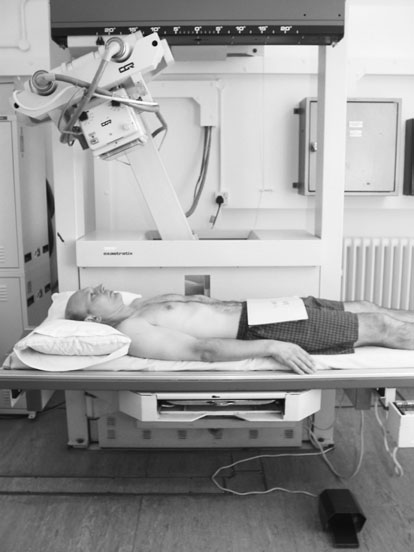 Imagine de tomografie liniară convențională care evidențiază regiunile renale fără umbrele gazelor și o