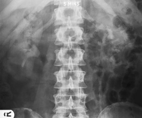 Figura 2: Aspect radiografic / Poziționare (Clark Ed. 12)
