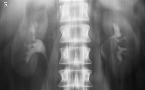 Figura 3: Aspect radiografic / Poziționare (Clark Ed. 12)