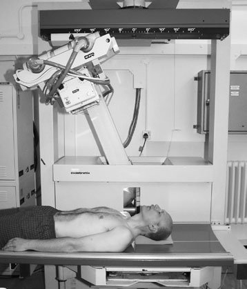 Computed Tomografie Liniară Convențională scout imagine evidențiind angle de trachea