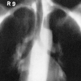 Figura 2: Aspect radiografic / Poziționare (Clark Ed. 12)