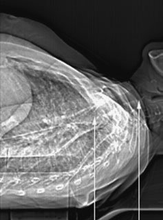 Figura 4: Aspect radiografic / Poziționare (Clark Ed. 12)