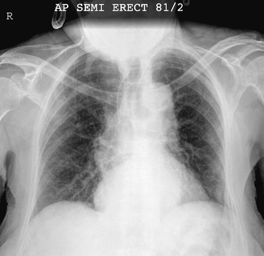 Figura 2: Aspect radiografic / Poziționare (Clark Ed. 12)
