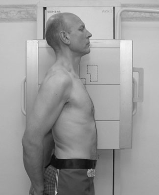 Figura 3: Aspect radiografic / Poziționare (Clark Ed. 12)