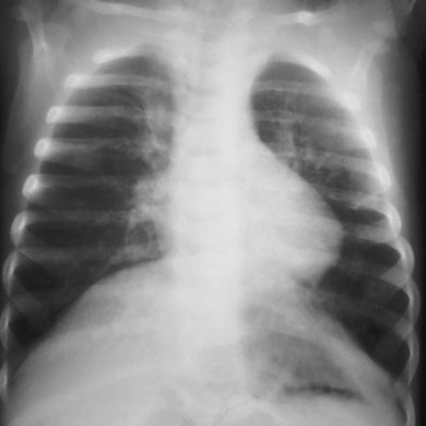 Figura 3: Aspect radiografic / Poziționare (Clark Ed. 12)