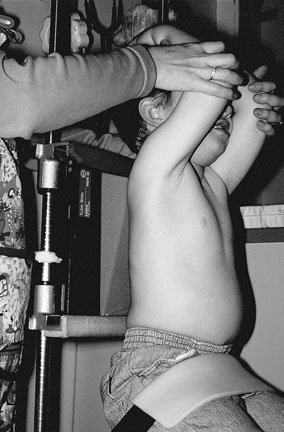 poziție de child pentru Antero-posterior (AP) chest radiografie