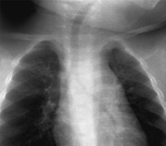 Figura 3: Aspect radiografic / Poziționare (Clark Ed. 12)