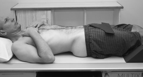 Imagine radiografică simplă a abdomenului în incidență antero-posterioară (AP), în decubit dorsal, care evidențiază polul inferior stâng