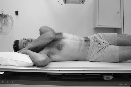 Radiografie de profil a abdomenului