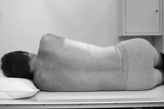 Figura 2: Aspect radiografic / Poziționare (Clark Ed. 12)