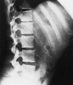 Figura 3: Aspect radiografic / Poziționare (Clark Ed. 12)