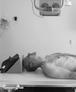 Plain radiografie este requested la investigate presence de
