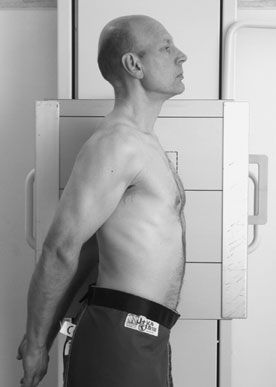 Profil (lateral) radiografie evidențiind normal