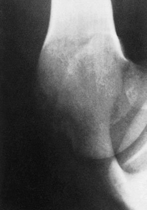 Figura 2: Aspect radiografic / Poziționare (Clark Ed. 12)