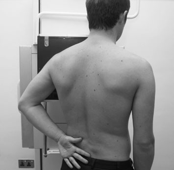 Normal radiografie de Profil (lateral) Umăr outlet
