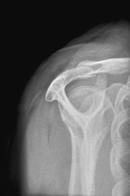 Figura 2: Aspect radiografic / Poziționare (Clark Ed. 12)